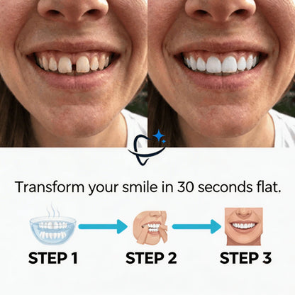 Éclatis™ Veneers